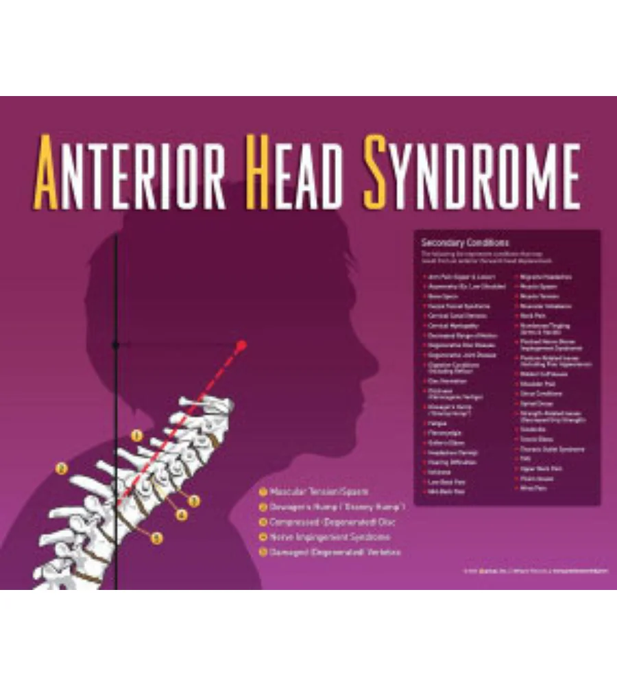 chiropractic care for back pain Eureka