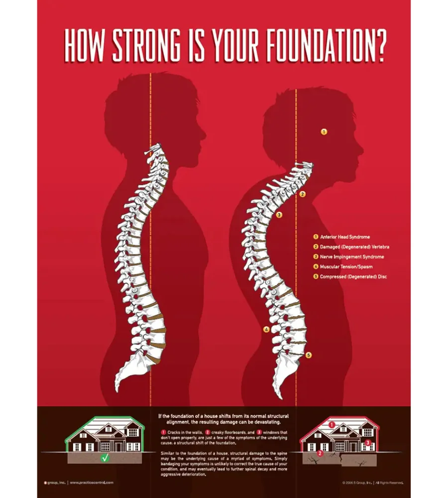 chiropractic care for back pain Eureka